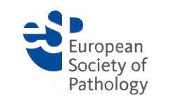 European Crohn´s and Organisation - ECCO - Published ECCO Guidelines